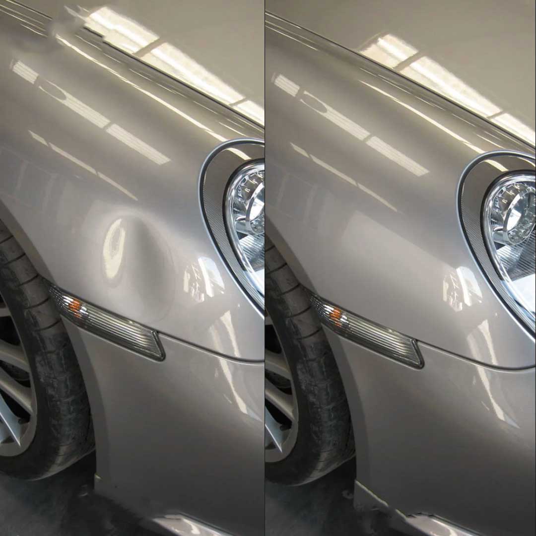 افزایش زیبایی